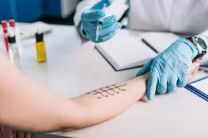 Zdravnik z modrimi nitril rokavicami preizkuša alergije na pacientu